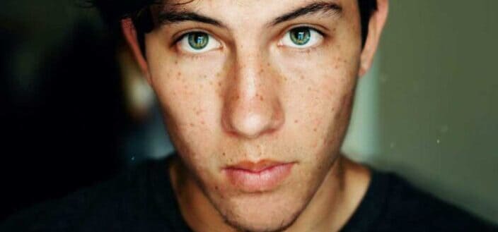 A man with freckles