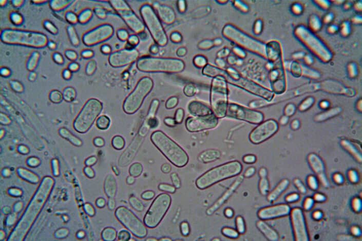 Microorganisms Under a Microscope