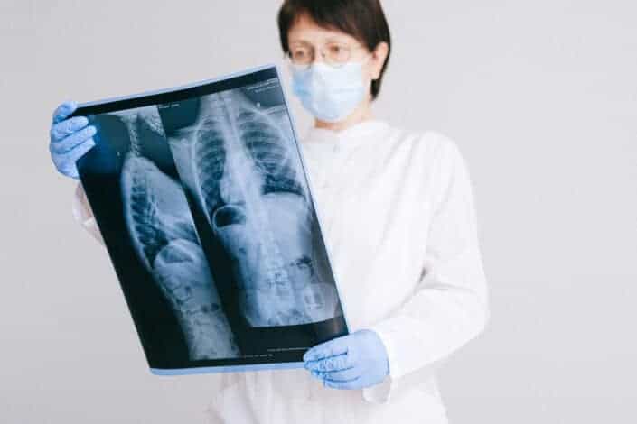 doctor looking at x-ray clipart
